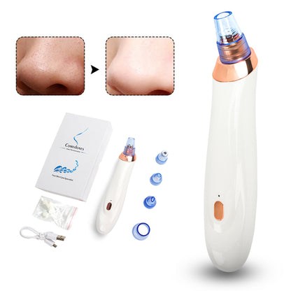 Acne/Blackhead Remover